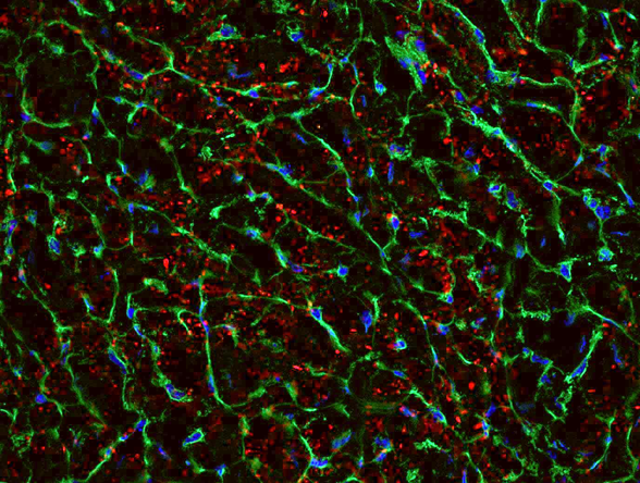 Wild-type mice expressing the mCherry-LC3 transgene under fasting conditions show increased LC3 puncta (red)